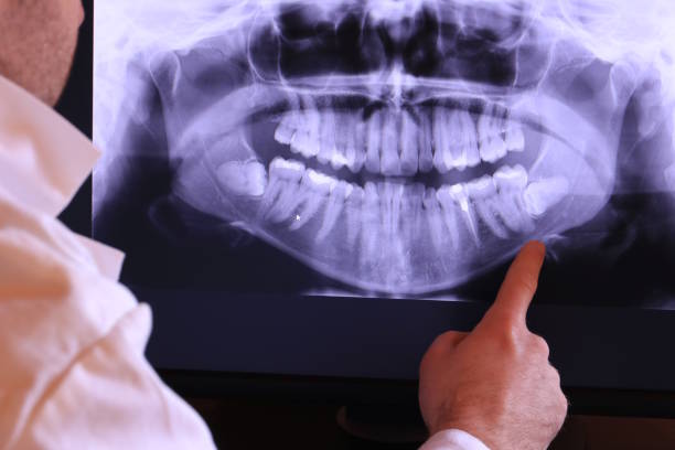 Best Cracked Tooth Emergency Dentist  in Phelan, CA